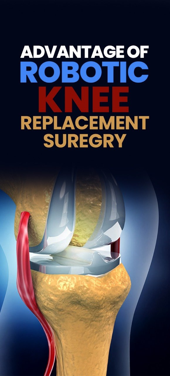 Robotic Knee Replacement Surgery