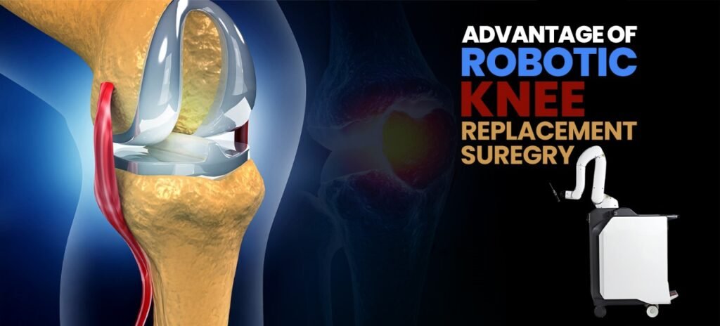Advantages of Robotic Knee Replacement Surgery