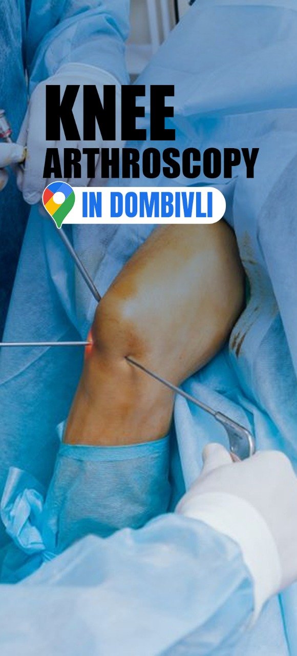 Knee Arthroscopy in Dombivli