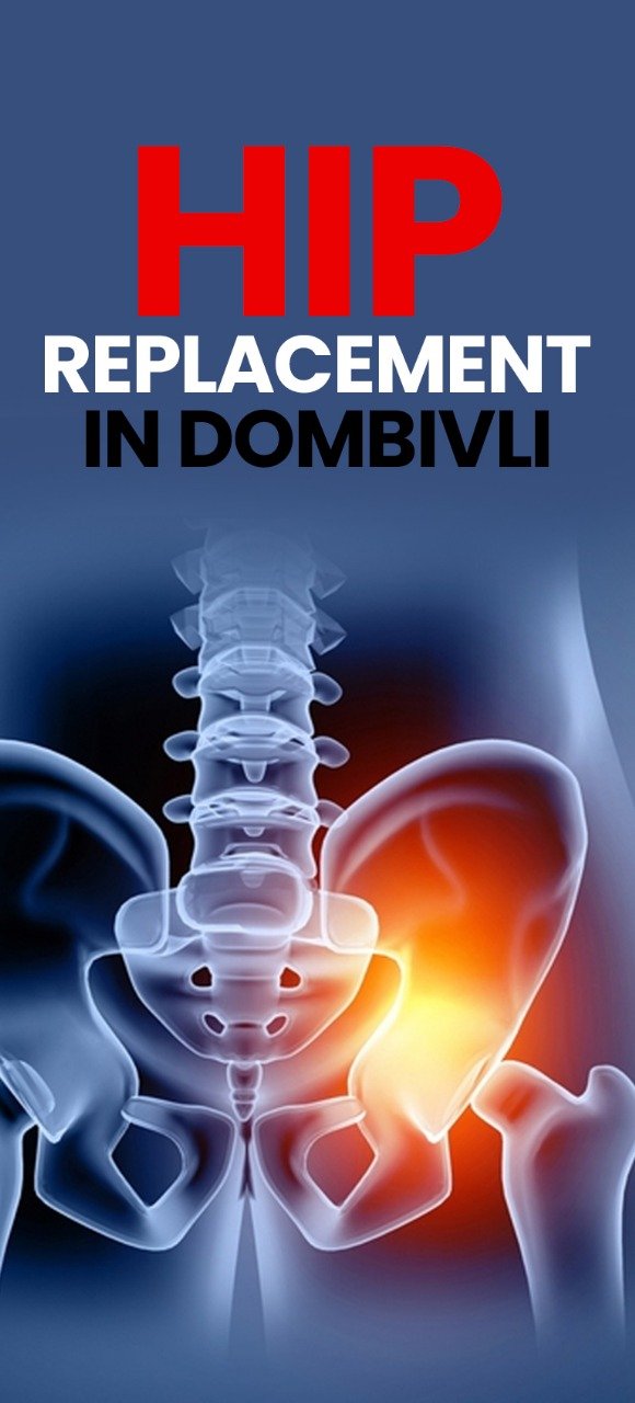 Hip Replacement Surgery