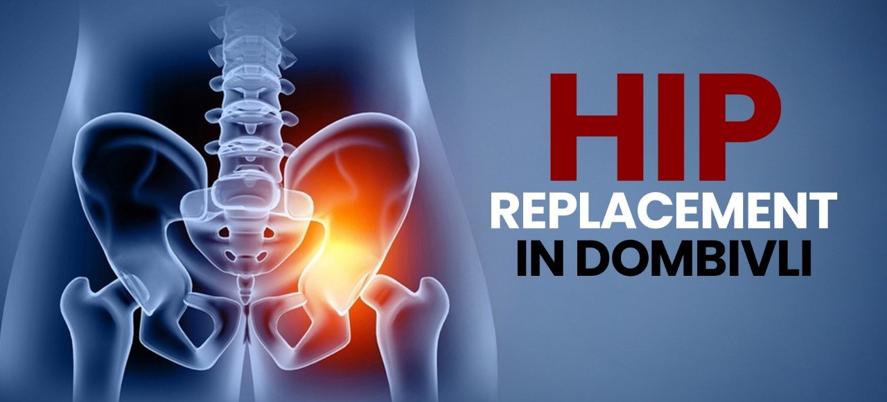Hip Replacement Surgery