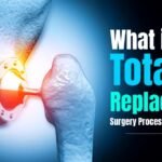 What is Total Hip Replacement: Surgery Process, Causes & Recovery