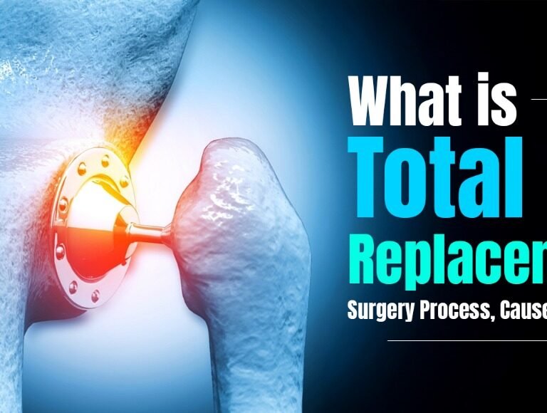 What is Total Hip Replacement: Surgery Process, Causes & Recovery